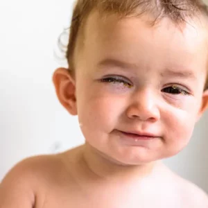 kaesemann homöopathie für kinder bindehautentzündung sp